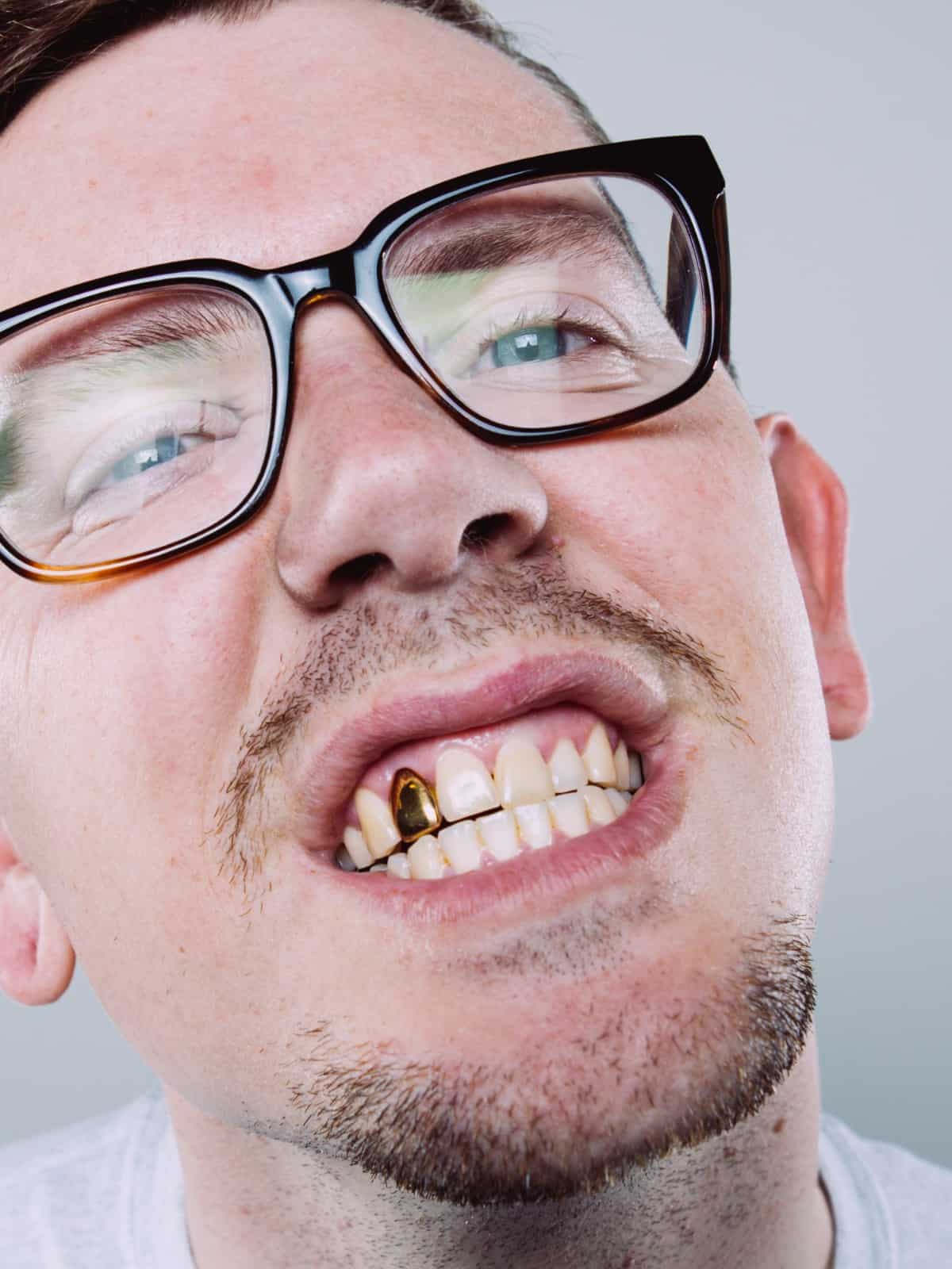 selling dental gold for cash in the UK